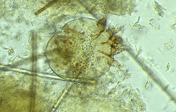 sarcoptes scabiei